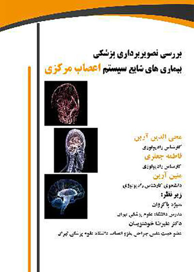 بررسی تصویربرداری پزشکی بیماری های شایع سیستم اعصاب مرکزی