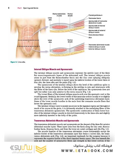 Master Techniques in Surgery: Hernia