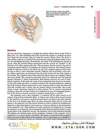 Master Techniques in Surgery: Hernia
