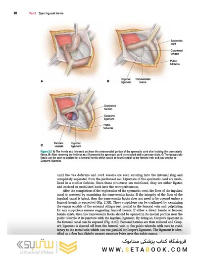 Master Techniques in Surgery: Hernia