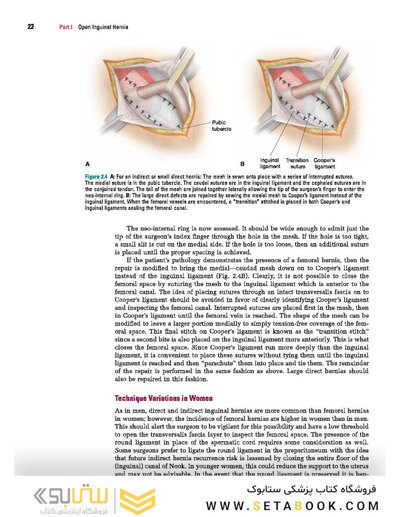Master Techniques in Surgery: Hernia