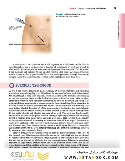 Master Techniques in Surgery: Hernia