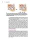 Master Techniques in Surgery: Hernia