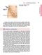 Master Techniques in Surgery: Hernia