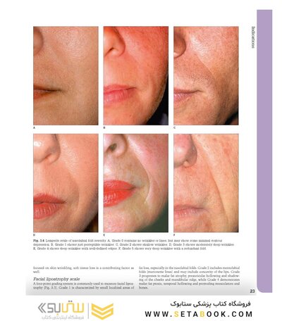 Aesthetic Plastic Surgery Video Atlas