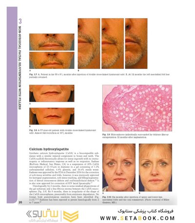 Aesthetic Plastic Surgery Video Atlas