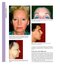 Aesthetic Plastic Surgery Video Atlas