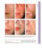 Aesthetic Plastic Surgery Video Atlas