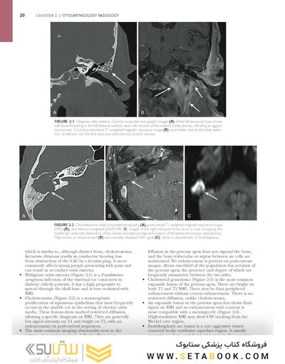 Self-Assessment in Otolaryngology