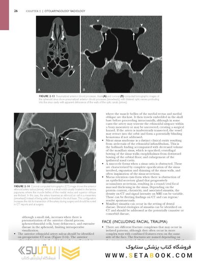Self-Assessment in Otolaryngology