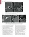 Self-Assessment in Otolaryngology