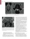 Self-Assessment in Otolaryngology