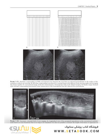 Ultrasound: The Requisites
