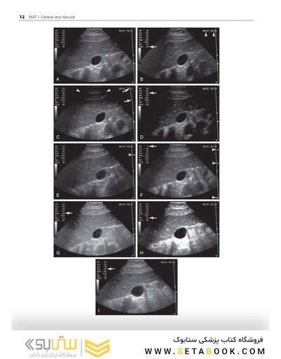 Ultrasound: The Requisites