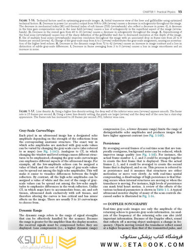Ultrasound: The Requisites