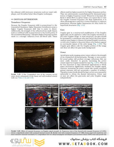Ultrasound: The Requisites