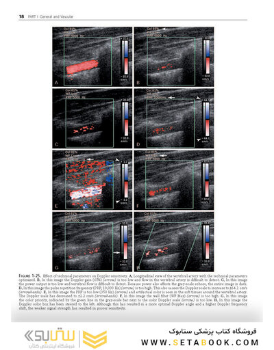 Ultrasound: The Requisites