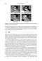 Fundamentals of Digital Image Processing : A Practical Approach with Examples in Matlab