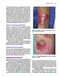 2019 Text and Atlas of Wound Diagnosis and Treatment, Second Edition 2nd Edition