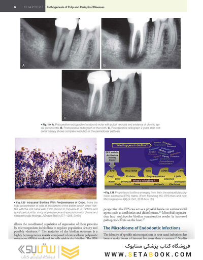 Endodontics: Principles and Practice 6th Edition 2021