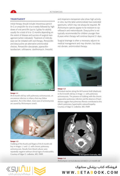 Red Book Atlas of Pediatric Infectious Diseases