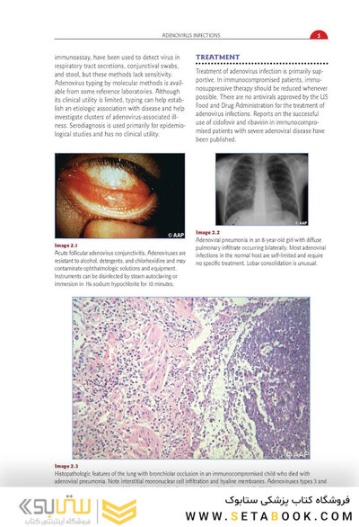 Red Book Atlas of Pediatric Infectious Diseases