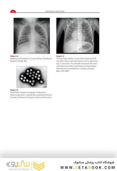 Red Book Atlas of Pediatric Infectious Diseases