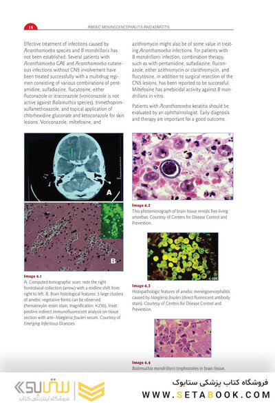 Red Book Atlas of Pediatric Infectious Diseases