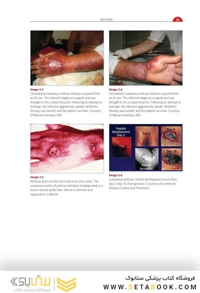 Red Book Atlas of Pediatric Infectious Diseases