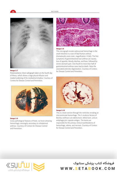 Red Book Atlas of Pediatric Infectious Diseases