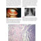 Red Book Atlas of Pediatric Infectious Diseases