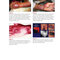 Red Book Atlas of Pediatric Infectious Diseases