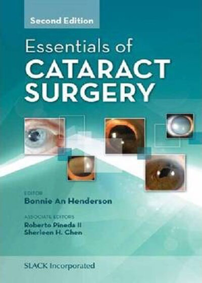 Essentials of Cataract Surgery 2nd Edition2014 موارد ضروری جراحی آب مروارید
