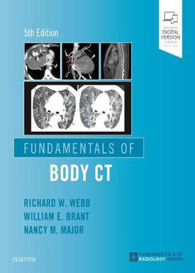 Fundamentals of Body CT (Fundamentals of Radiology) 2020 5th Edition