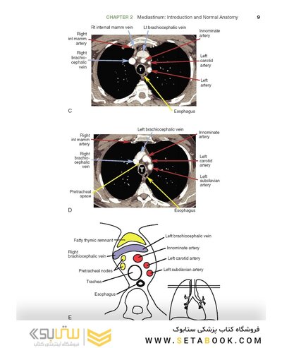 Fundamentals of Body CT (Fundamentals of Radiology) 2020 5th Edition