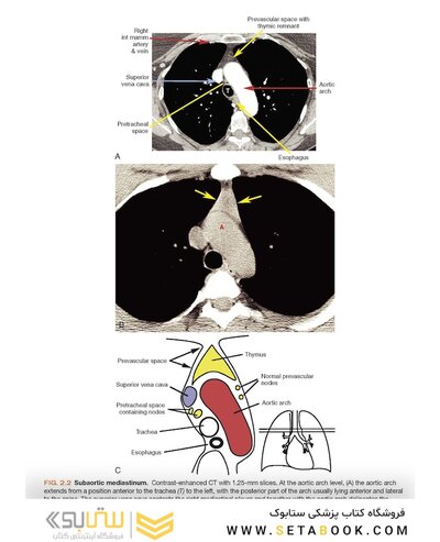 Fundamentals of Body CT (Fundamentals of Radiology) 2020 5th Edition