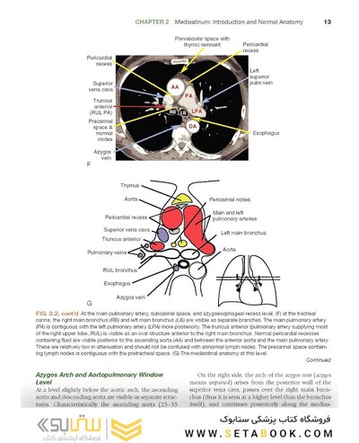 Fundamentals of Body CT (Fundamentals of Radiology) 2020 5th Edition