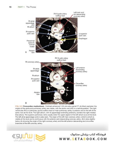 Fundamentals of Body CT (Fundamentals of Radiology) 2020 5th Edition