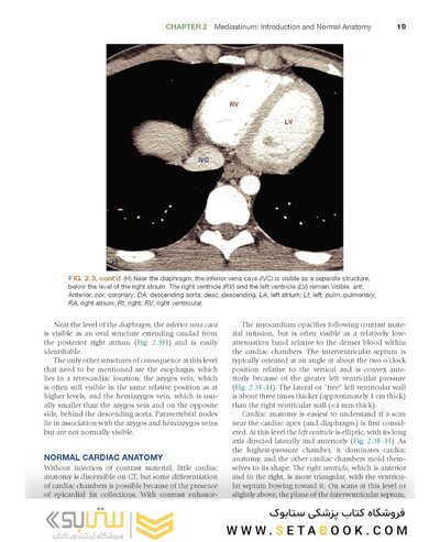 Fundamentals of Body CT (Fundamentals of Radiology) 2020 5th Edition