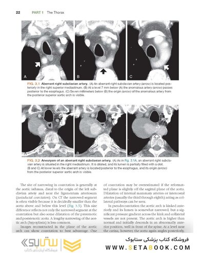 Fundamentals of Body CT (Fundamentals of Radiology) 2020 5th Edition