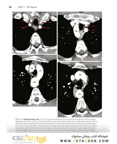 Fundamentals of Body CT (Fundamentals of Radiology) 2020 5th Edition