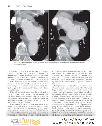 Fundamentals of Body CT (Fundamentals of Radiology) 2020 5th Edition