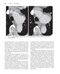 Fundamentals of Body CT (Fundamentals of Radiology) 2020 5th Edition