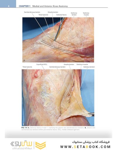 Noyes’ Knee Disorders: Surgery, Rehabilitation, Clinical Outcomes, 2nd Edition 2016