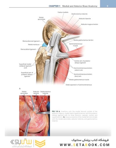 Noyes’ Knee Disorders: Surgery, Rehabilitation, Clinical Outcomes, 2nd Edition 2016