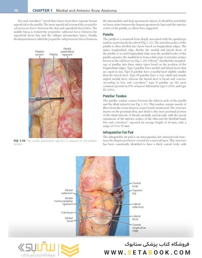Noyes’ Knee Disorders: Surgery, Rehabilitation, Clinical Outcomes, 2nd Edition 2016