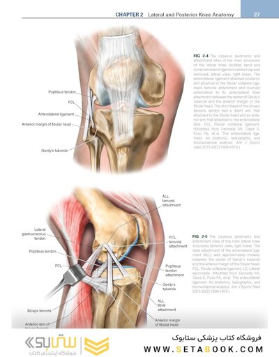 Noyes’ Knee Disorders: Surgery, Rehabilitation, Clinical Outcomes, 2nd Edition 2016