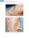 Noyes’ Knee Disorders: Surgery, Rehabilitation, Clinical Outcomes, 2nd Edition 2016