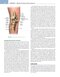 Noyes’ Knee Disorders: Surgery, Rehabilitation, Clinical Outcomes, 2nd Edition 2016