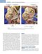Noyes’ Knee Disorders: Surgery, Rehabilitation, Clinical Outcomes, 2nd Edition 2016